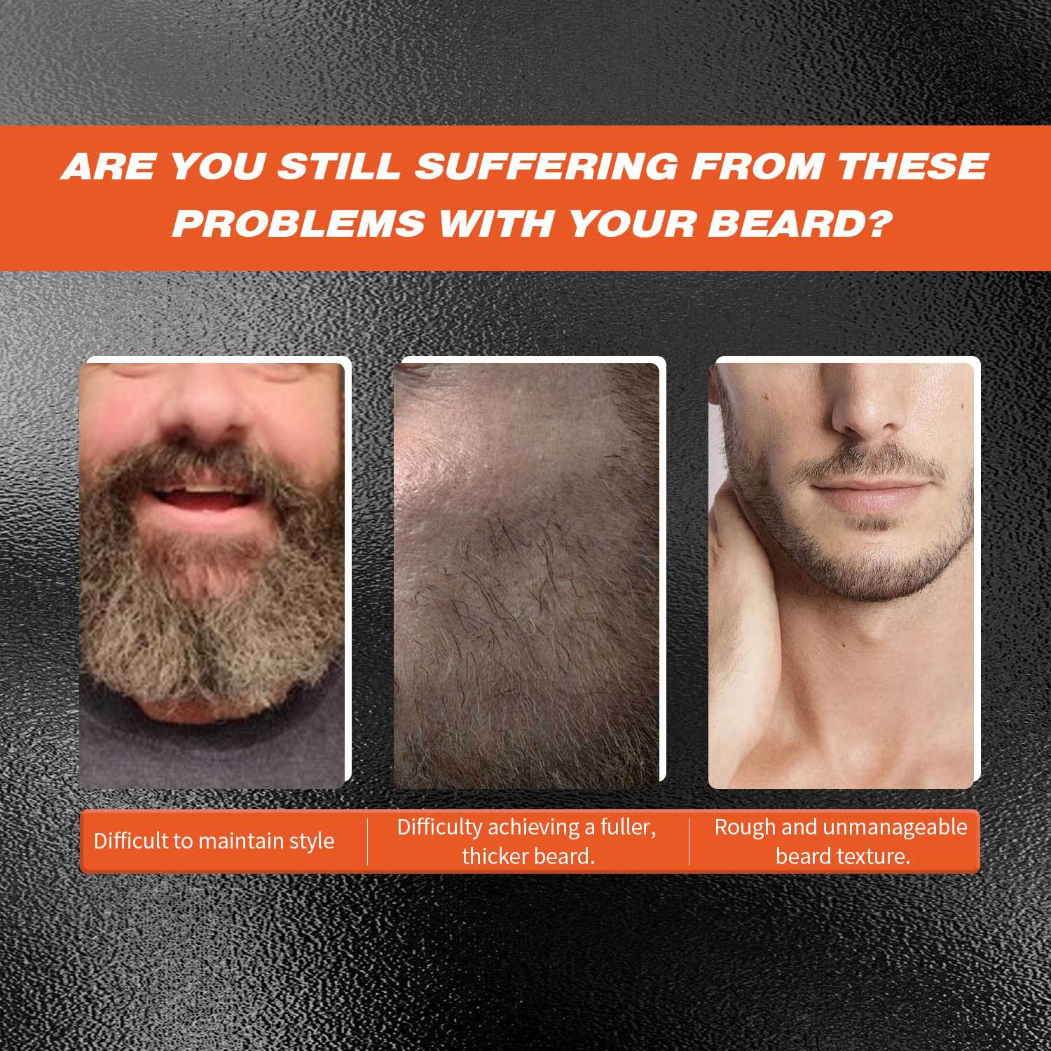 Beard 30ml Microneedle Roller